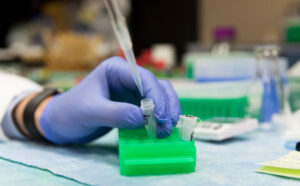 Gloved hand and pipette